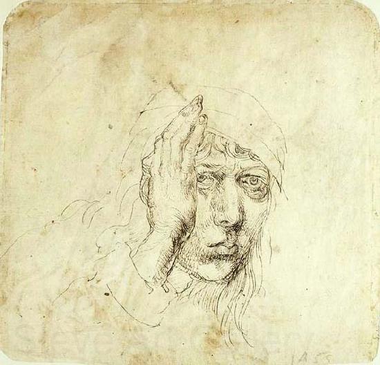 Albrecht Durer Self-Portrait with a Bandage France oil painting art